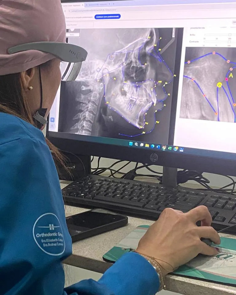 Análisis de radiografía en pantalla en Soymca